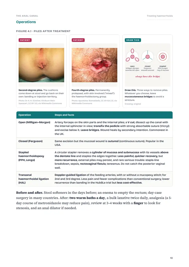 The Anus and Anal Canal, page 10: Inside the chapter