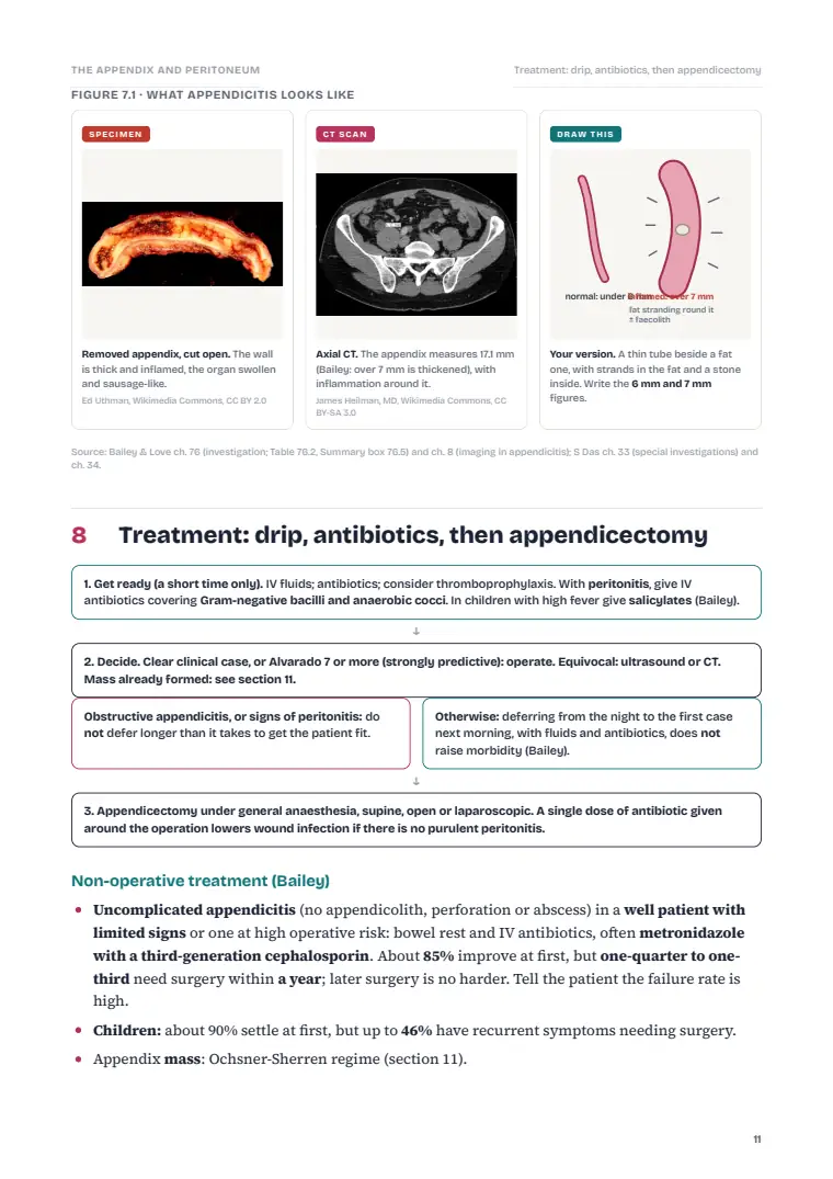The Vermiform Appendix and the Peritoneum, page 11: Inside the chapter