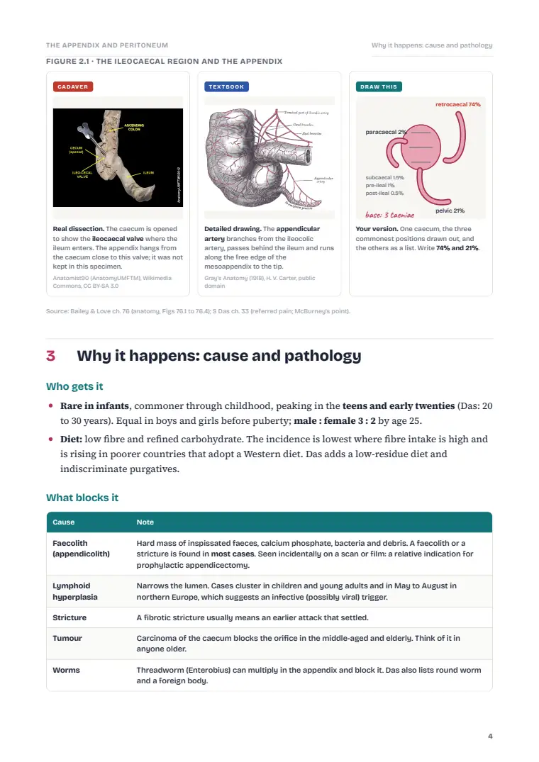 The Vermiform Appendix and the Peritoneum, page 4: Inside the chapter