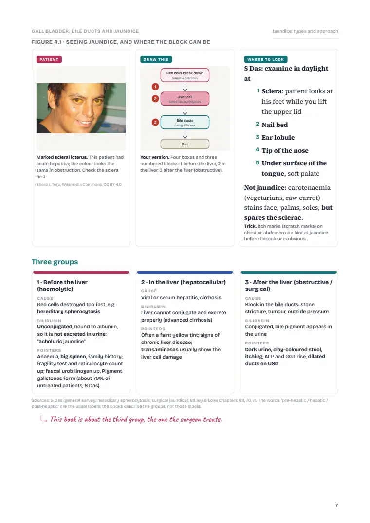 The Gallbladder and Bile Ducts, page 7: Inside the chapter