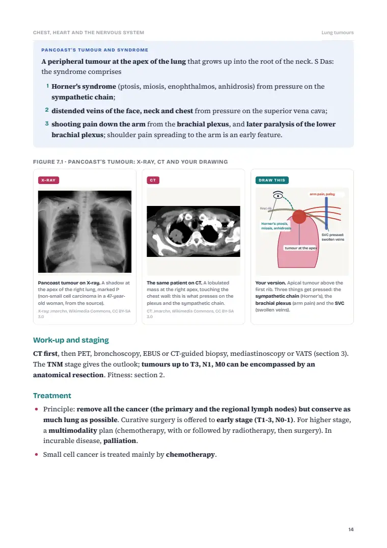 Cranial Neurosurgery, Cardiac Surgery and the Thorax, page 14: Inside the chapter