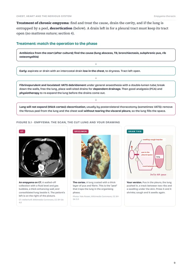 Cranial Neurosurgery, Cardiac Surgery and the Thorax, page 9: Inside the chapter