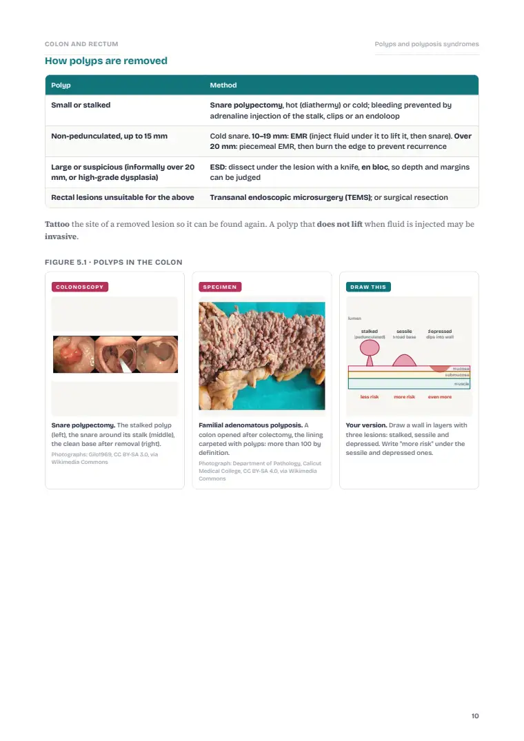 The Large Intestine and Rectum, page 10: Inside the chapter