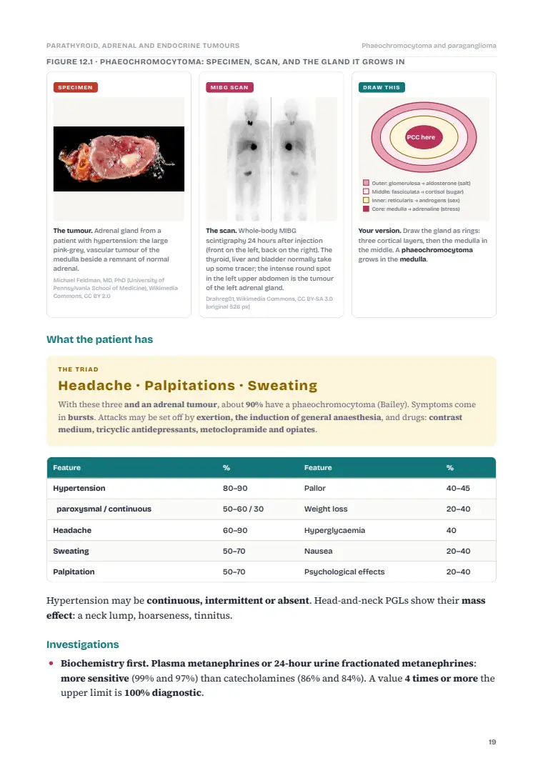 The Parathyroid and Adrenal Glands, page 19: Inside the chapter
