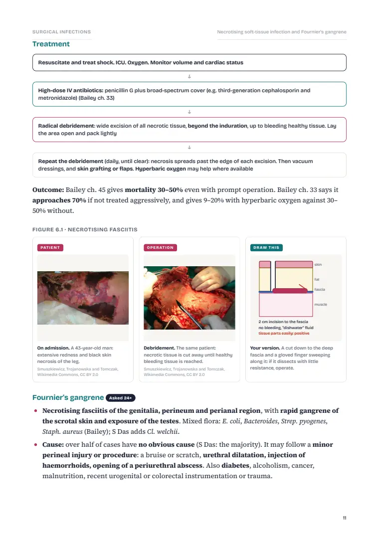 Surgical Infection, page 11: Inside the chapter