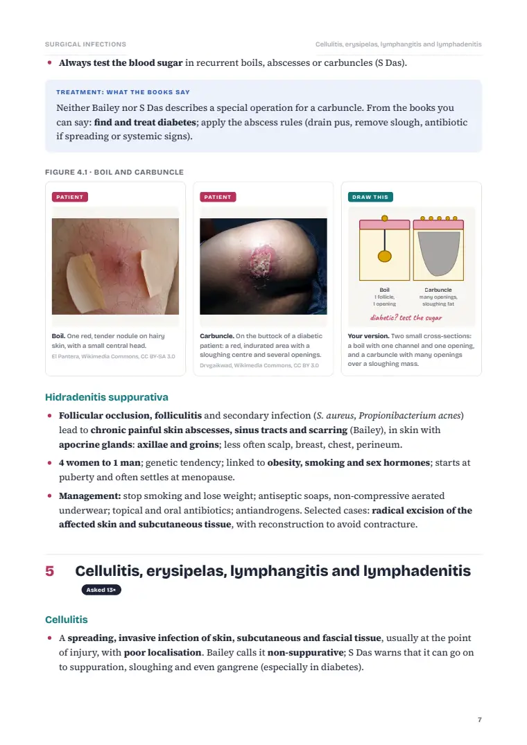 Surgical Infection, page 7: Inside the chapter
