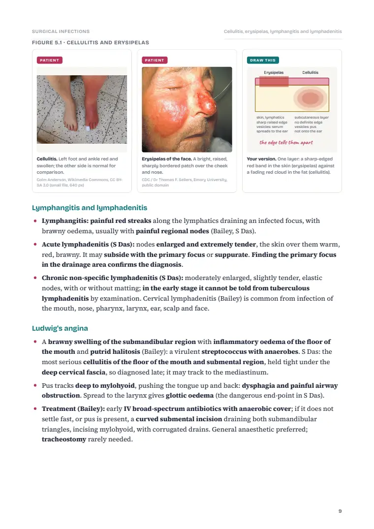 Surgical Infection, page 9: Inside the chapter