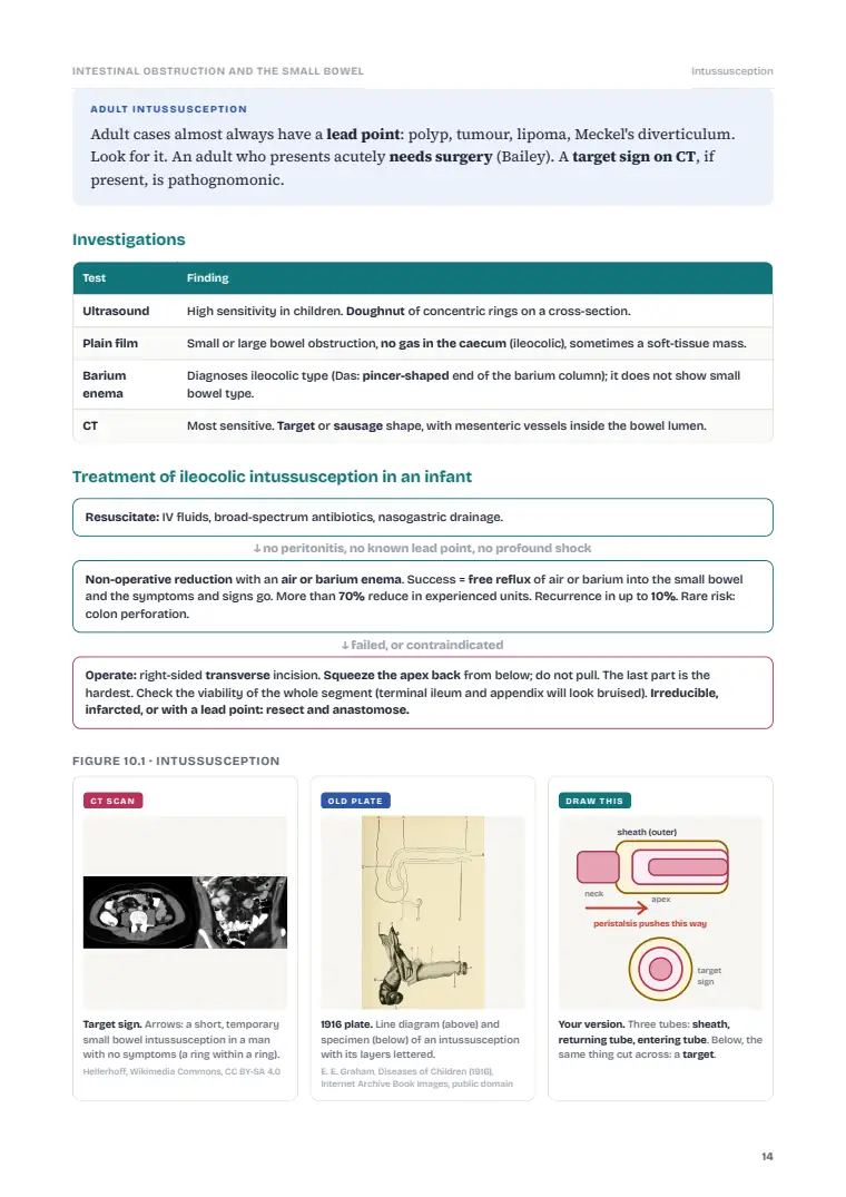 The Small Intestine and Intestinal Obstruction, page 14: Inside the chapter