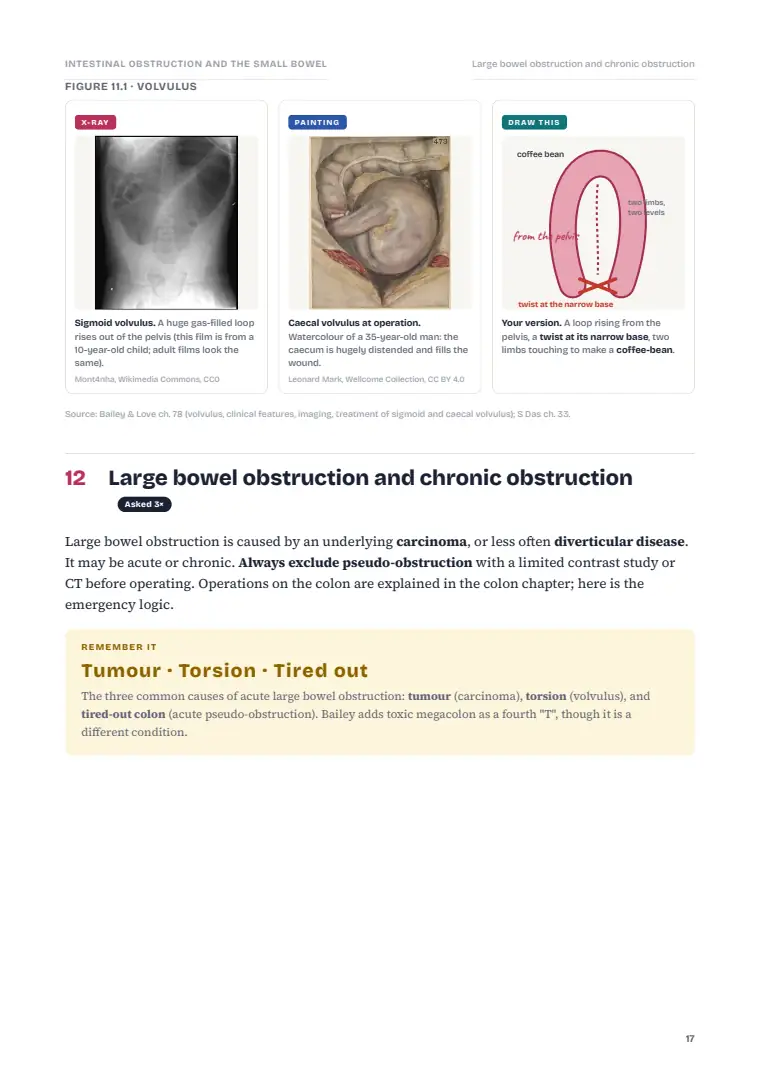 The Small Intestine and Intestinal Obstruction, page 17: Inside the chapter