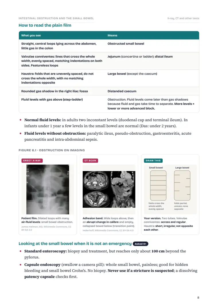 The Small Intestine and Intestinal Obstruction, page 8: Inside the chapter