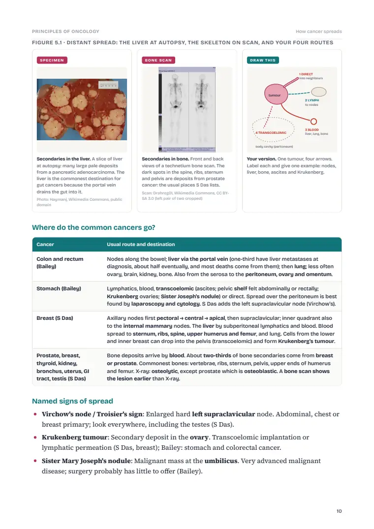 Principles of Oncology, page 10: Inside the chapter