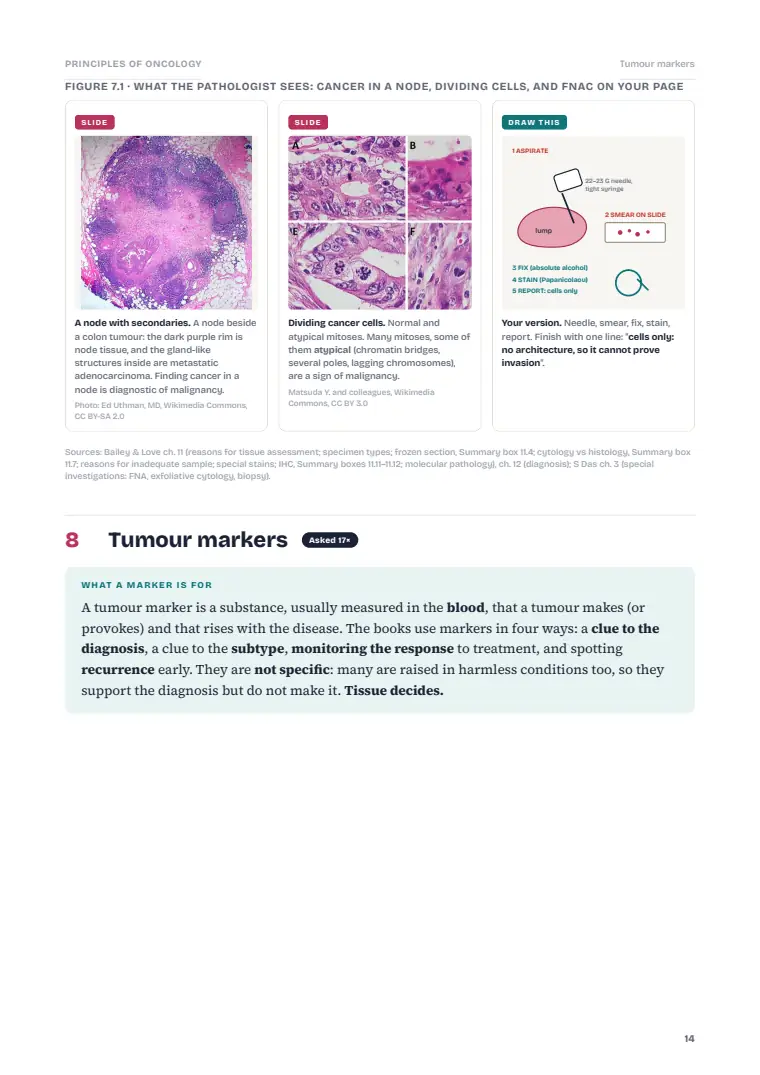 Principles of Oncology, page 14: Inside the chapter