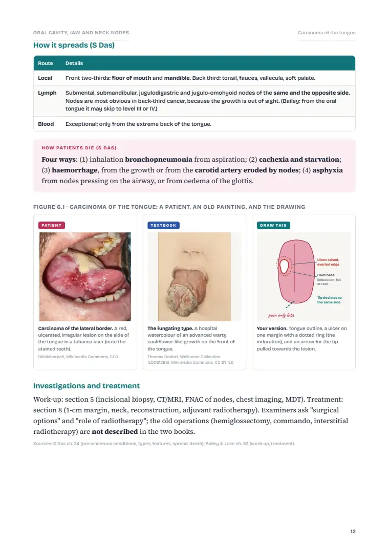 Oral Cavity Cancer and the Neck, page 12: Inside the chapter