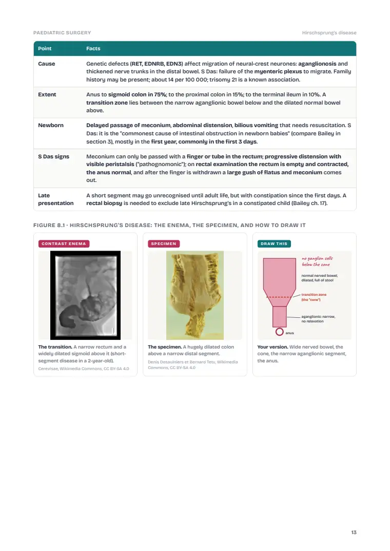 Paediatric and Neonatal Surgery, page 13: Inside the chapter