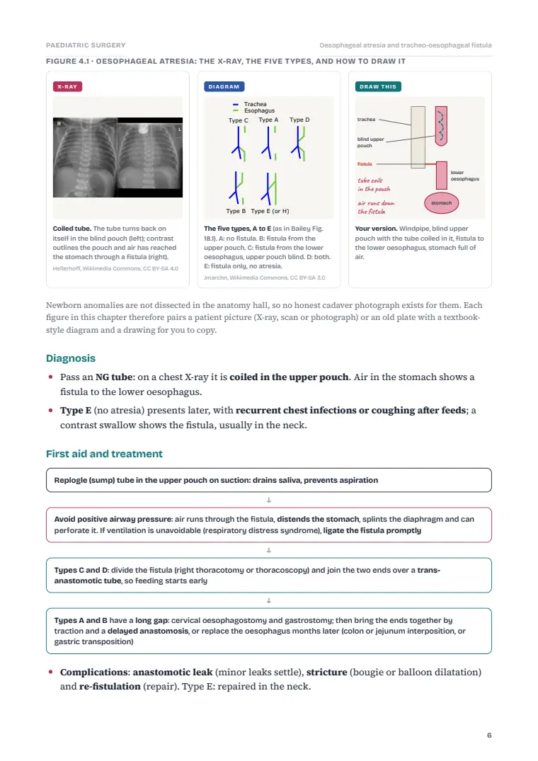 Paediatric and Neonatal Surgery, page 6: Inside the chapter