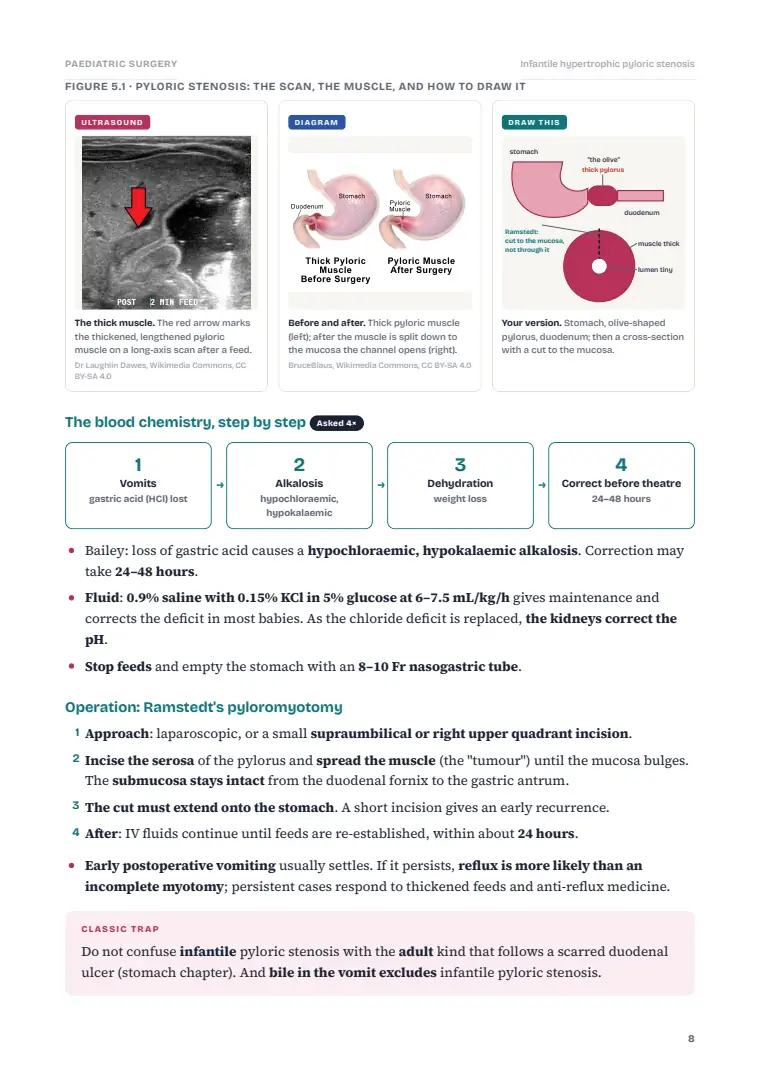 Paediatric and Neonatal Surgery, page 8: Inside the chapter