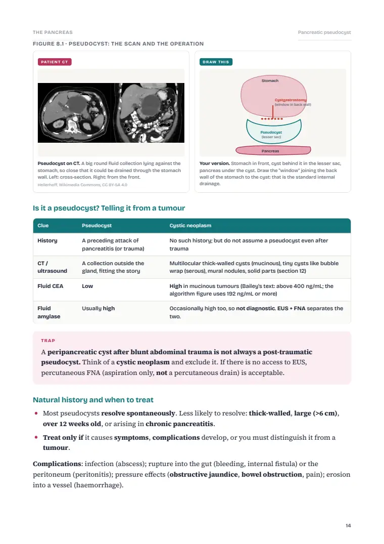 The Pancreas, page 14: Inside the chapter