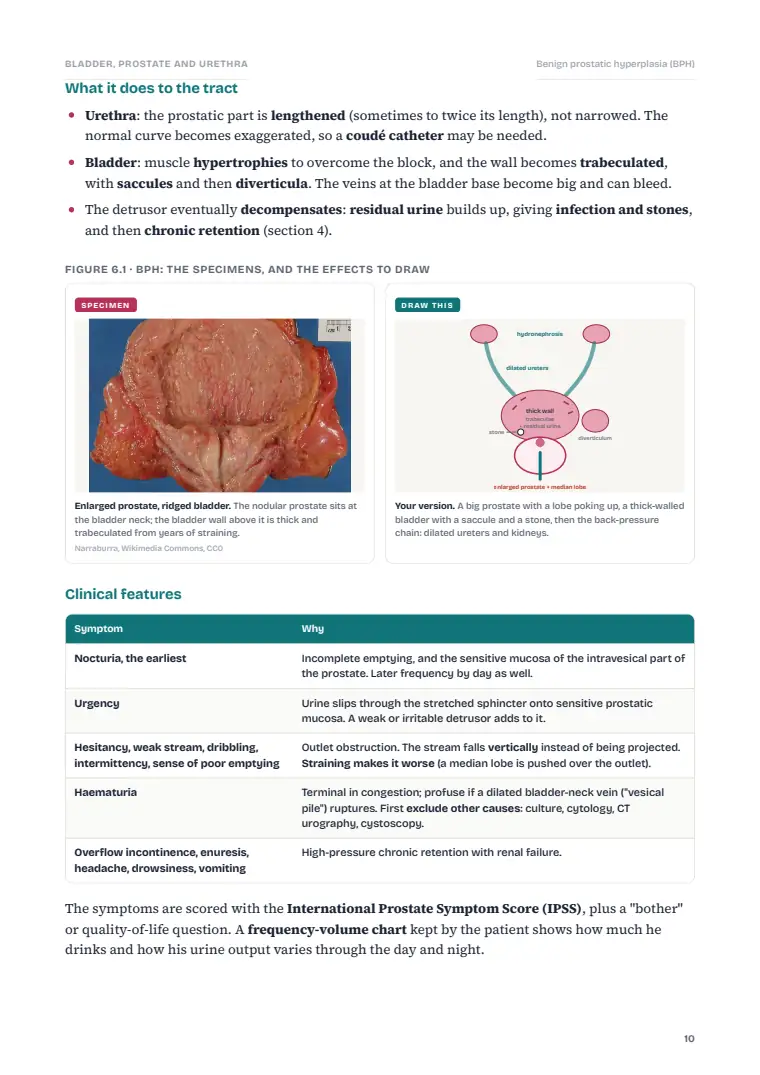 The Urinary Bladder, Prostate and Urethra, page 10: Inside the chapter