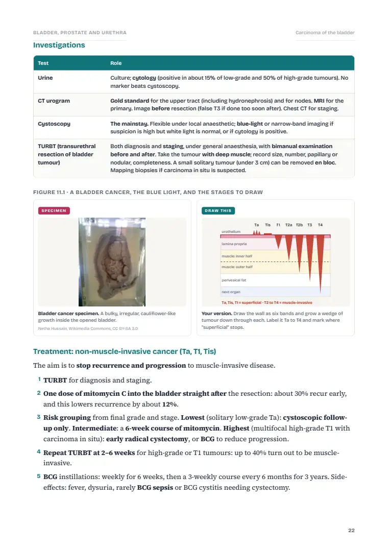 The Urinary Bladder, Prostate and Urethra, page 22: Inside the chapter
