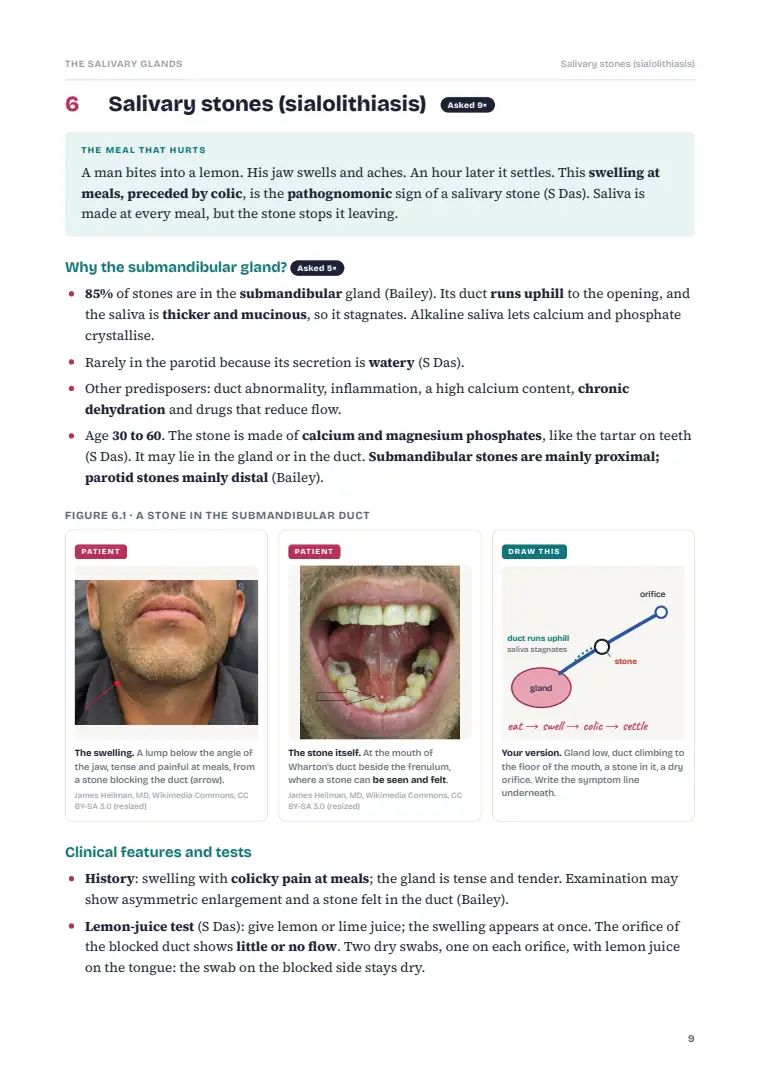 Disorders of the Salivary Glands, page 9: Inside the chapter