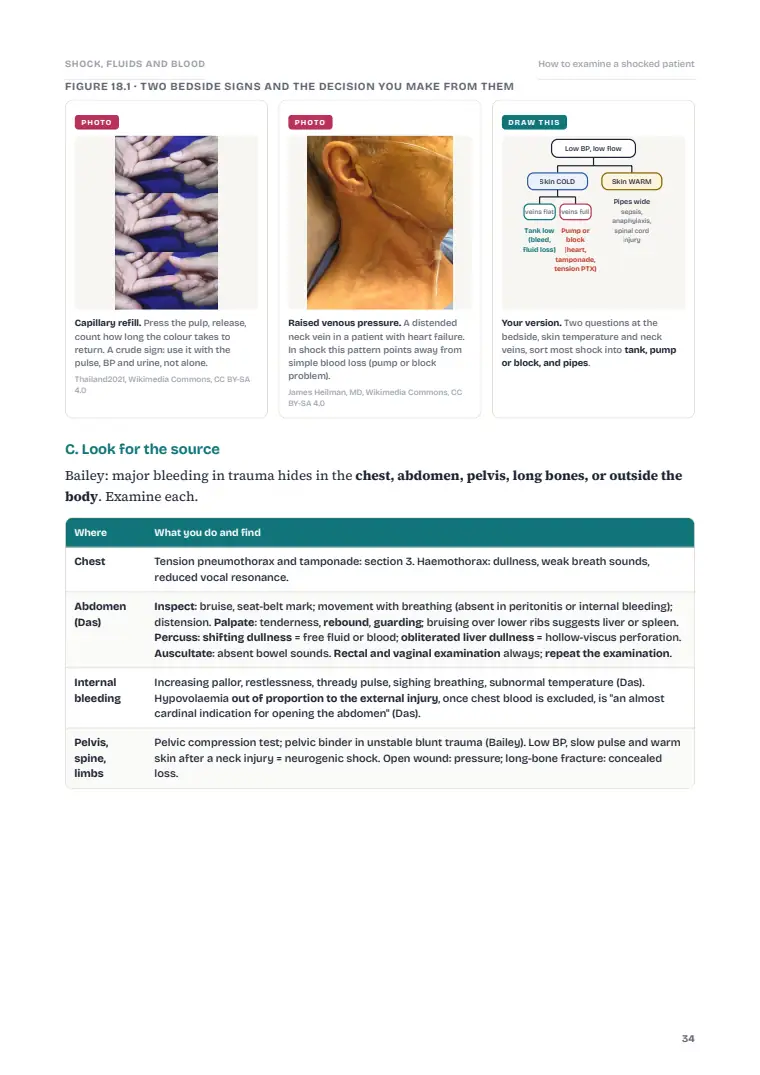 Shock, Haemorrhage and Transfusion, page 34: Inside the chapter
