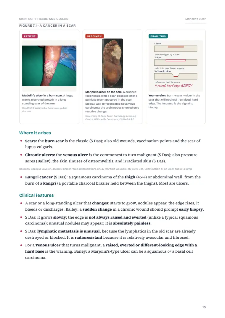 Skin and Subcutaneous Tissue, page 10: Inside the chapter