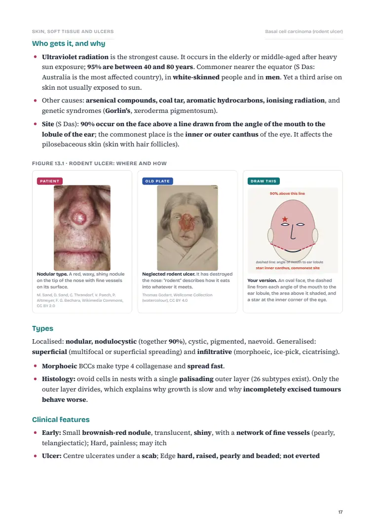 Skin and Subcutaneous Tissue, page 17: Inside the chapter