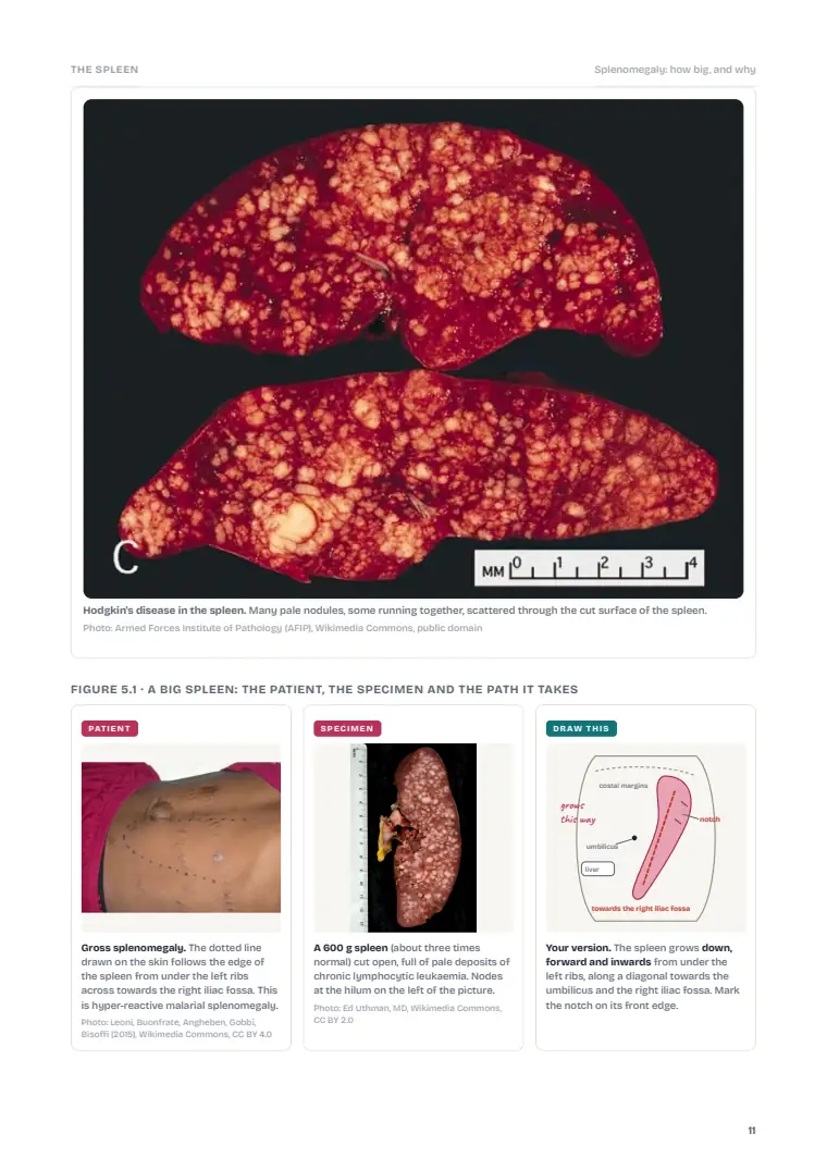 The Spleen, page 11: Inside the chapter