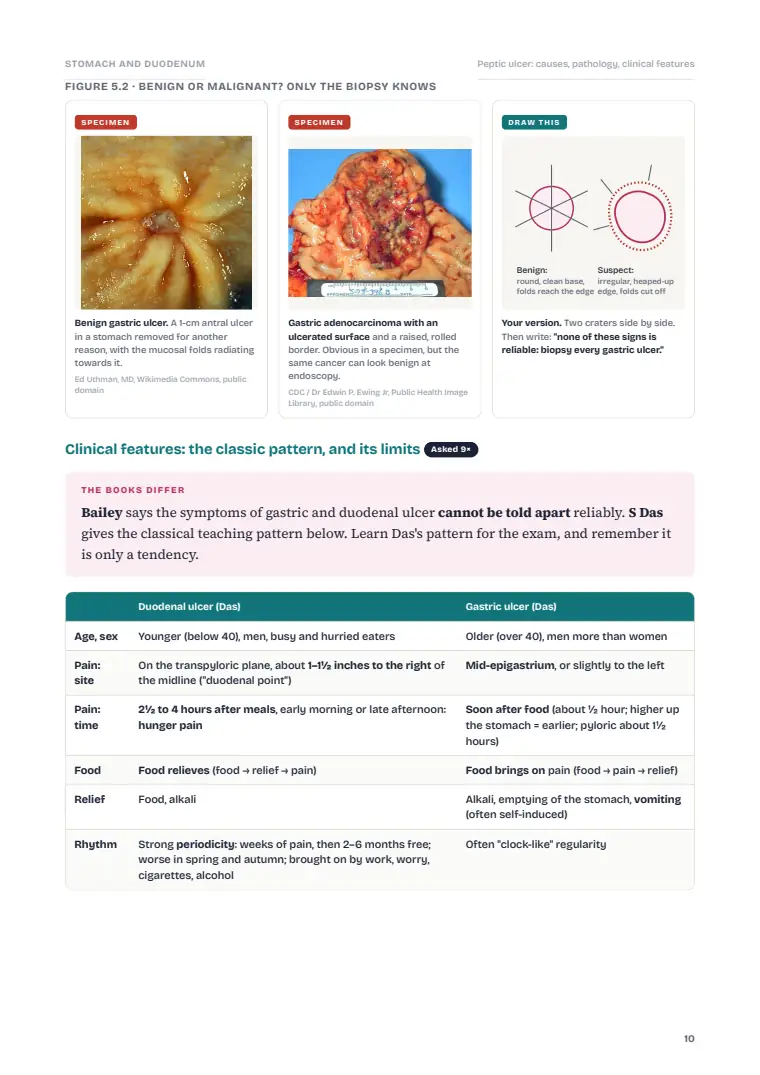 The Stomach and Duodenum, page 10: Inside the chapter