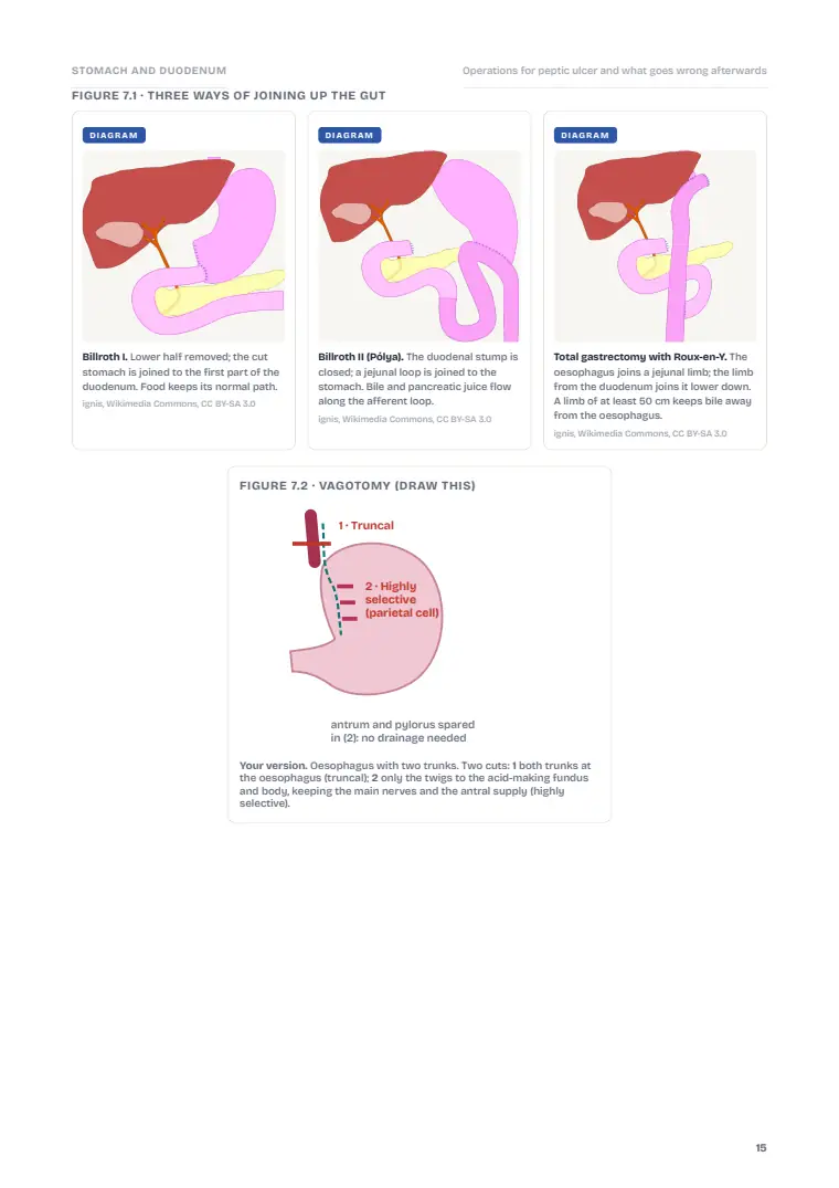 The Stomach and Duodenum, page 15: Inside the chapter