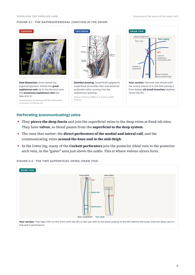 Venous Disorders, page 4: Inside the chapter