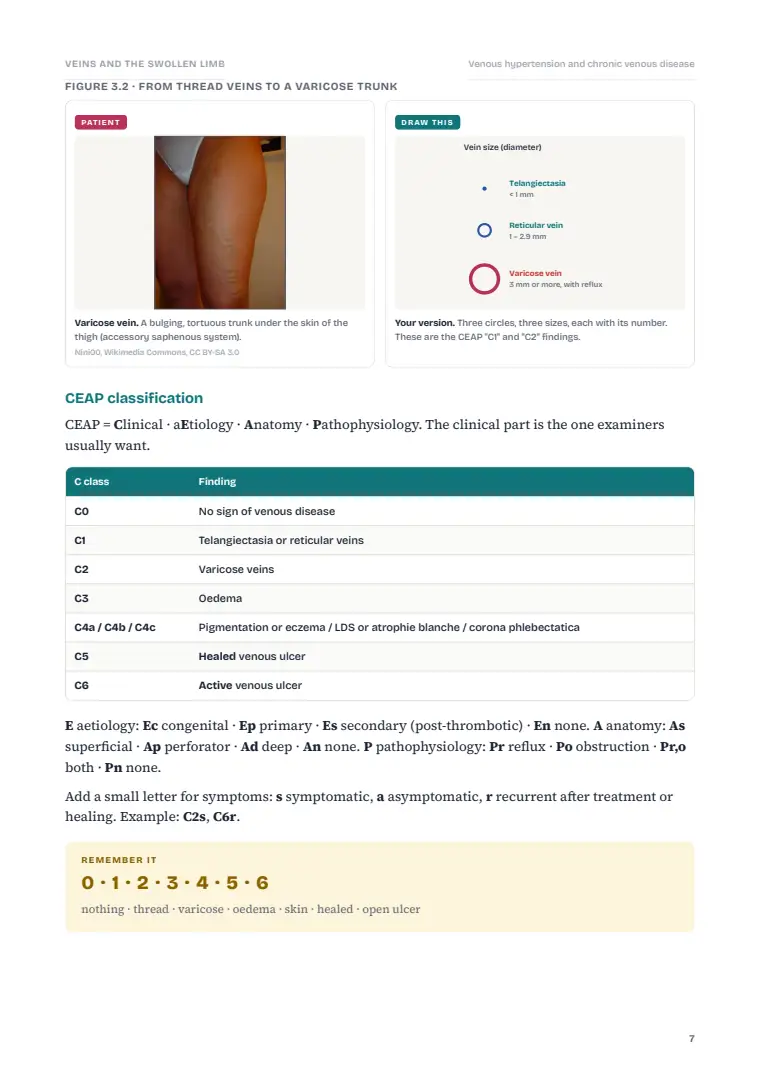 Venous Disorders, page 7: Inside the chapter
