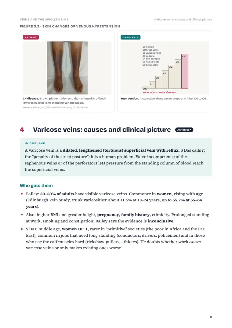 Venous Disorders, page 8: Inside the chapter