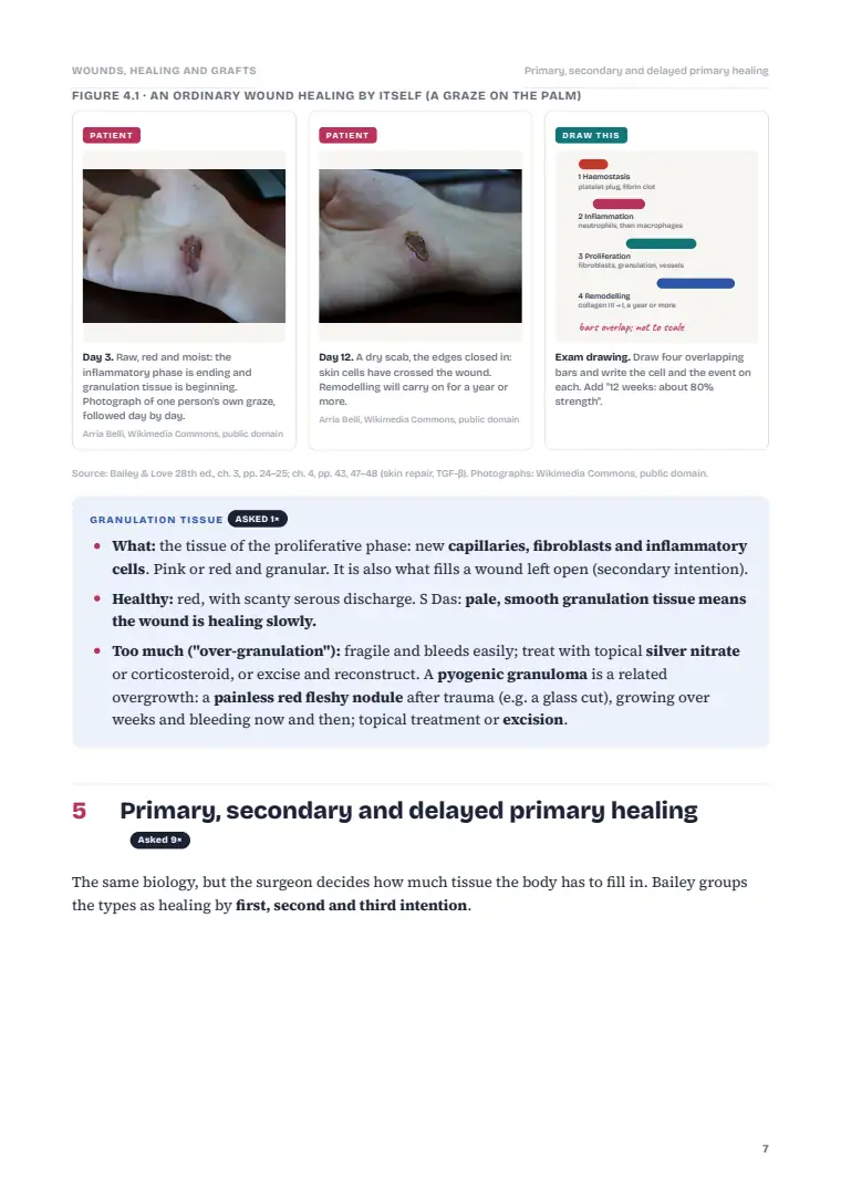 Wound Healing and Tissue Repair, page 7: Inside the chapter